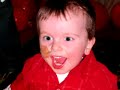 Faces of ARPKD/CHF