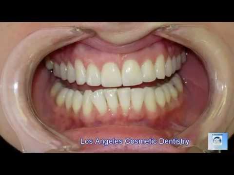 Los Angeles Cosmetic Dentist