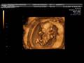 LenaNey 11 weeks