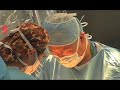 what-are-the-types-of-hip-surgery-hip-replacement-featuring-dr-sculco-arthritismd.html