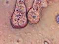 Processed Amoeba video clip