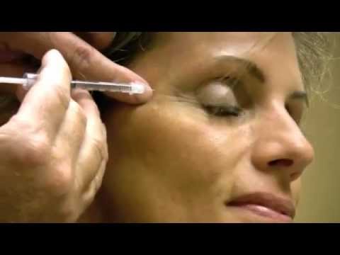 Aplicação de Botox - Toxina Botulínica