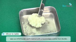 video thumbnail Auto-Tooth Bone Graft System : BonMaker youtube