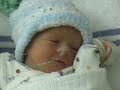 Brannan and Callum - Early Days Jaundice in newborns