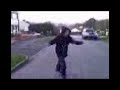 skateboard to the face