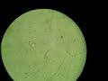 Espermatoz�ide na aula de Microscopia