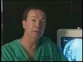 Dr Mclucas explains fibroids embolization