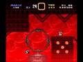 TSRPR - Braindamaged Finale: Normal Exit