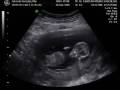videos de Nuestros Bebes / 12 Semanas