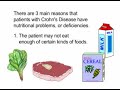 Crohn\