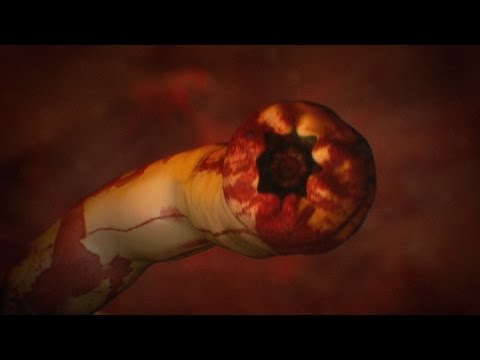 how to get rid of worms inside u
