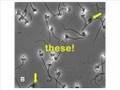 SPERM HEALTH - ACROSOME ASSESSMENT
