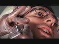 Human Guinea Pigs - Wax or Zap