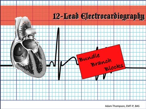 how to treat lbbb