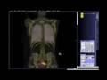 PETCT Biograph