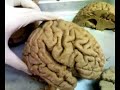 gyrus-sulcus of cerebrum ) gyrus-sulcus of cerebrum )
