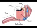 Sleep Apnea and the CPAP Machine