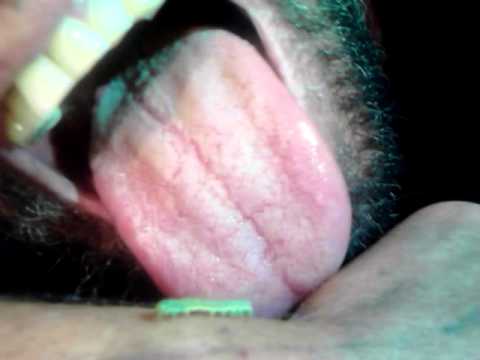 how to get rid roundworms