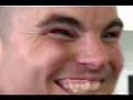 Travis Bagent