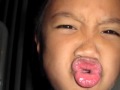 Thumbnail #1
