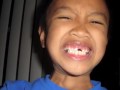 Thumbnail #2