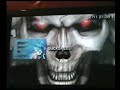 psp test ms