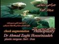 malar implant and rhinoplasty