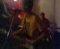 Sunstroke