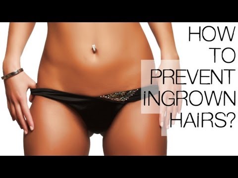 how to avoid ingrown hair