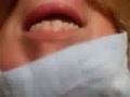 Chin Faces