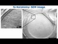 Ziemer LDV. Advanced lamellar disection!