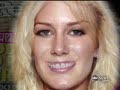 nightline - heidi montag addicted to beauty. 100122.