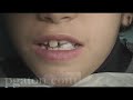 Saliva Check Buffer GC