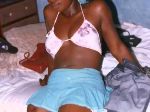 black amputee woman sak right above the knee amputee RAK and model