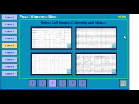 abnormalities - Review of focal findings on the EEG.