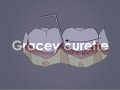 Uni of Adelaide how to use scalers and curettes.
