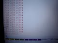KXM52 accelerometer