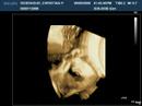 baby ridenhour