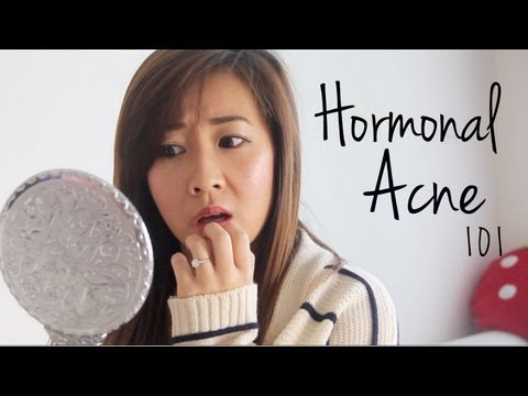 how to cure hormonal acne naturally