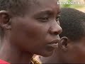 La maldición de los albinos