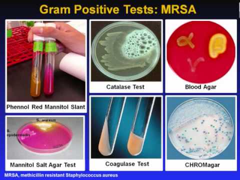 how to test for e coli in urine