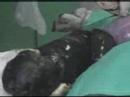 Veterinarian performing a cesarean on a dog (Part 4)
