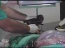 Veterinarian performing a cesarean on a dog (Part 4)