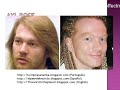 27- Plastic Surgery Fail (before after) 27 - Cirurgia Plastica - Antes Despues  - youtube