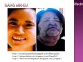 Plastic Surgery Fail before after Cirugía Plástica fallo antes después Пластическая хирургия Сбой до после 形成外科は後にする前に失敗する før efter الجراحة البلاستيكية قبل بعد فشل Blog: ruimpracaramba.blogspot.com (português) http (english) elpeordelmundo.blogspot.com (español)