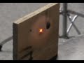 Laser High Power YAG burns!