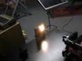 Laser High Power YAG burns!