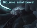 Small Bowel Anastomosis Small Bowel Anastomosis