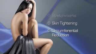 CARISMED LIPOKONTUR - Using 3 energies for CELLULITE, STRETCH MARKS, SKIN TIGHTENING