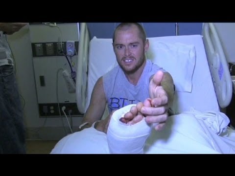 Surfer: Shark bit me, so I bit back